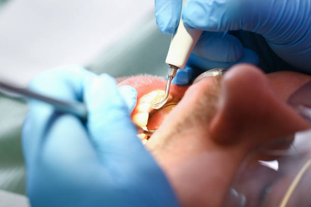 Best Chipped Tooth Repair Near Me  in Sundown, TX