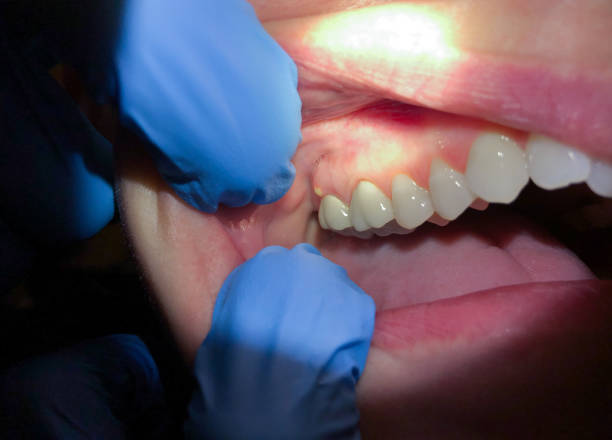 Best Cracked Tooth Emergency Dentist  in Sundown, TX